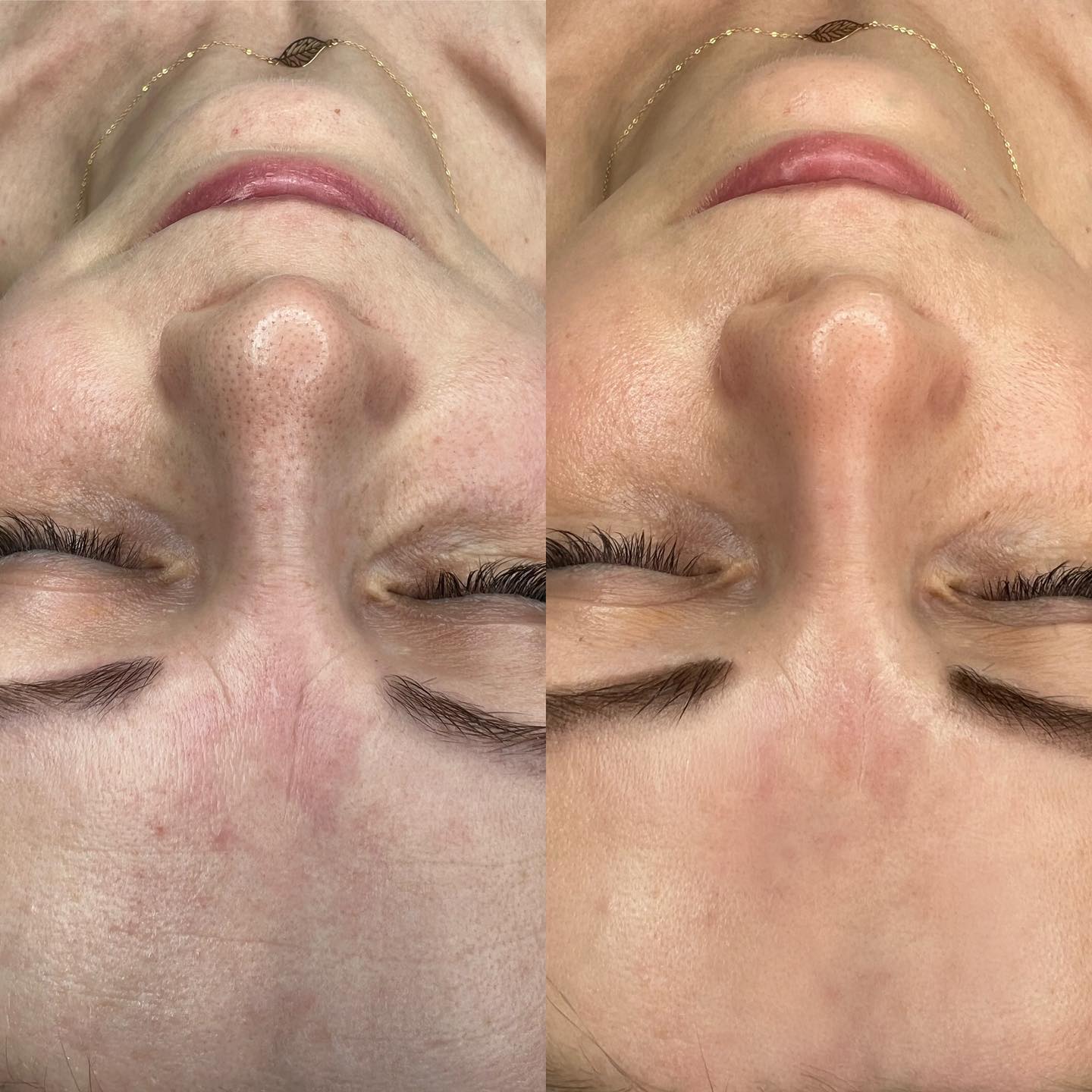 Brows & Lashes image